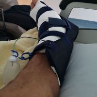Gabriel Batistuta fue operado con éxito y mostró la prótesis que le colocaron