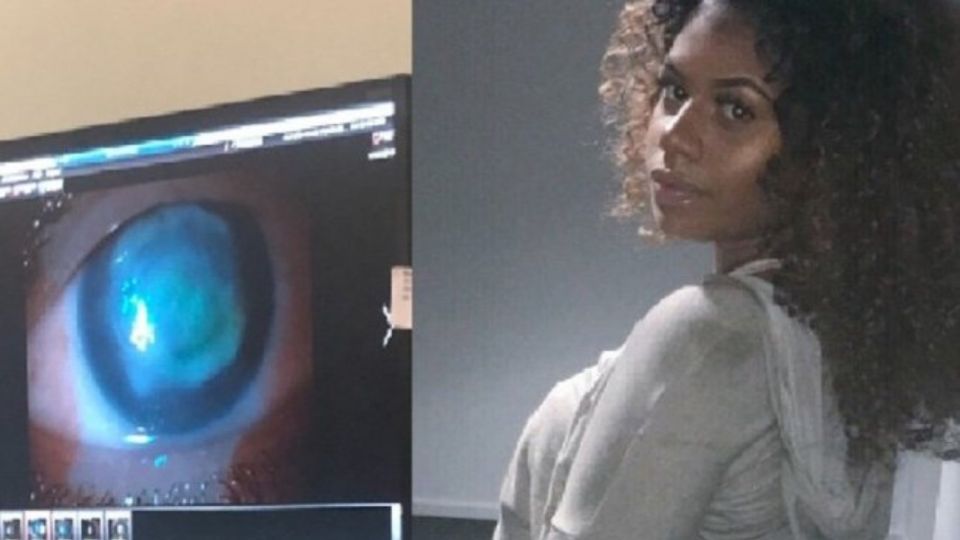 La joven tuvo que dejar su trabajo y sus estudios a raíz de una infección ocular que le provocó la pérdida de visión.