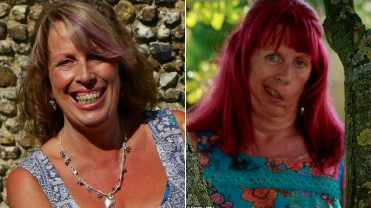 Sandra Liddell, de 56 años, antes y después de sus problemas de salud.