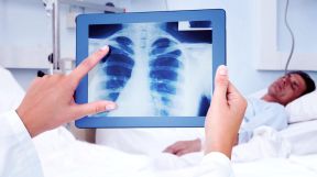 tuberculosis 20191025
