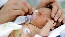Malformaciones cardiacas. Como cuidar el corazon de los bebes.