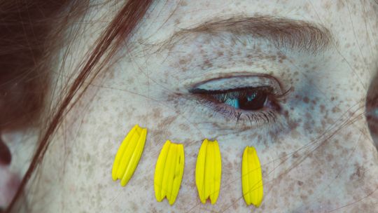 Decile chau al bisturí: los tratamientos faciales alternativos a la cirugías
