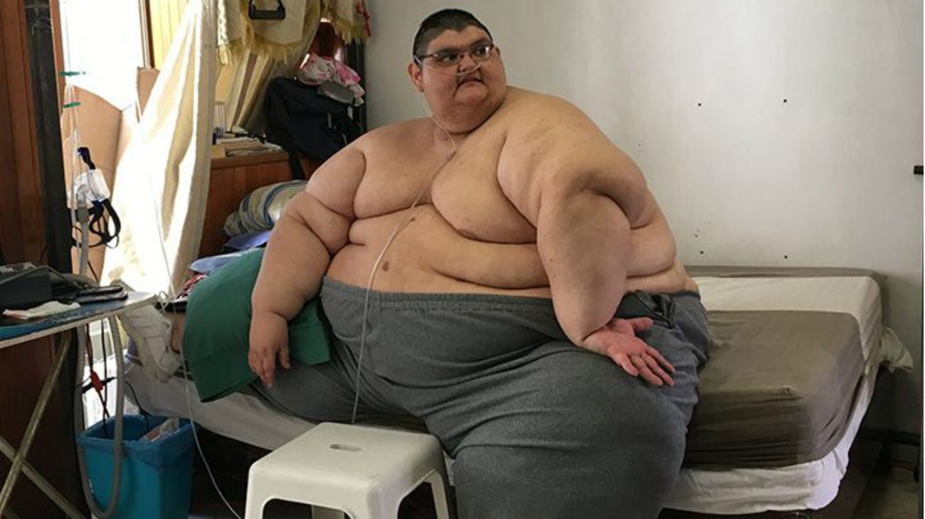 Juan Pedro Franco llegó a pesar 595 kg. Hoy, en 2019, pesa 260,8 kilos.