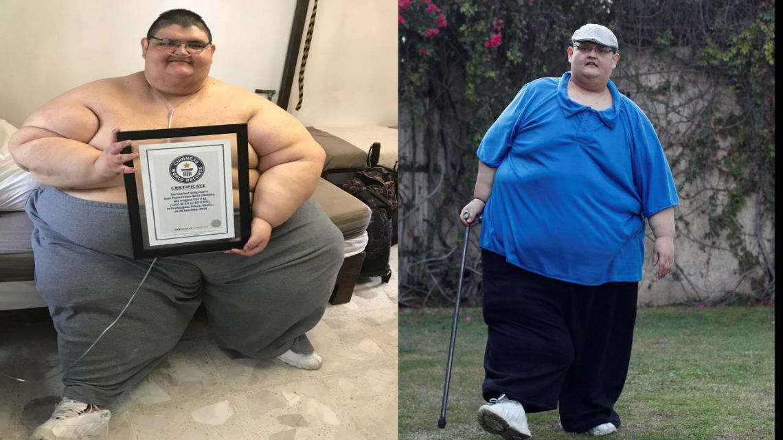 La lucha del hombre más obeso del mundo por bajar de peso y 