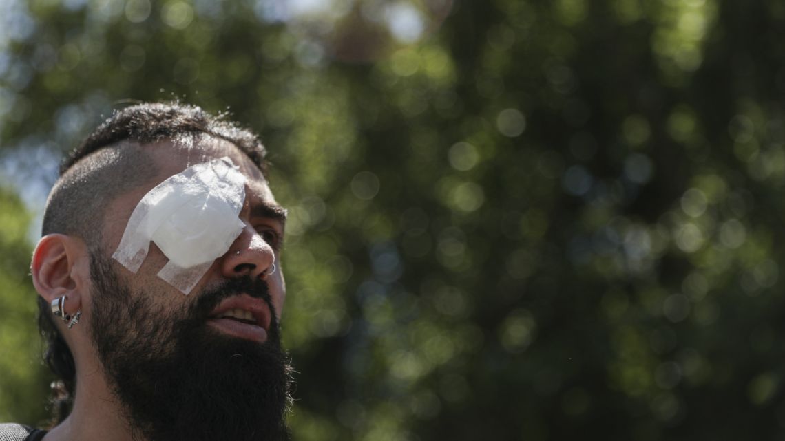 Marcelo Herrera, his eye bandaged from an injury he received during recent protests, takes part in a demonstration in support of protesters who have been injured in the eye by Chilean police, in Santiago