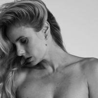 Famosas al desnudo hablan de cáncer de piel en la campaña de concientización #unminutoportupiel