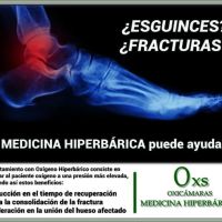 Oxicamaras