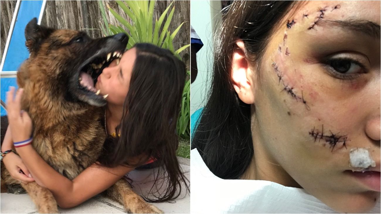 Jugaba Con Su Perro En La Pileta Y El Animal Le Desfigur La Cara Perfil