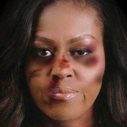 Michelle Obama golpeada
