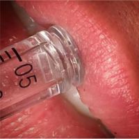 Nova Estética Avanzada