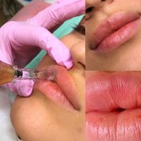 Nova Estética Avanzada