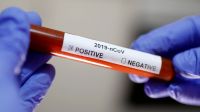 test coronavirus dw
