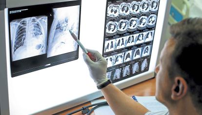 Tuberculosis. Es la enfermedad infecciosa más difundida.