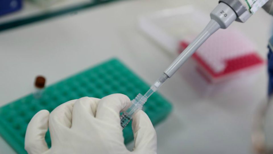 El número de casos de COVID-19 a nivel mundial había los 400.000 hasta este 24 de marzo, de acuerdo con el Centro de Ciencia e Ingeniería de Sistemas (CSSE, por sus siglas en inglés) de la Universidad Johns Hopkins.