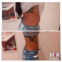 Mia Estetica