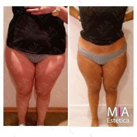 Mia Estetica