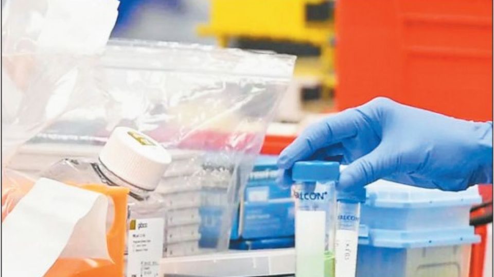 TRATAMIENTO. En algunos países se extrae el plasma de pacientes con COVID-19 para casos graves.
