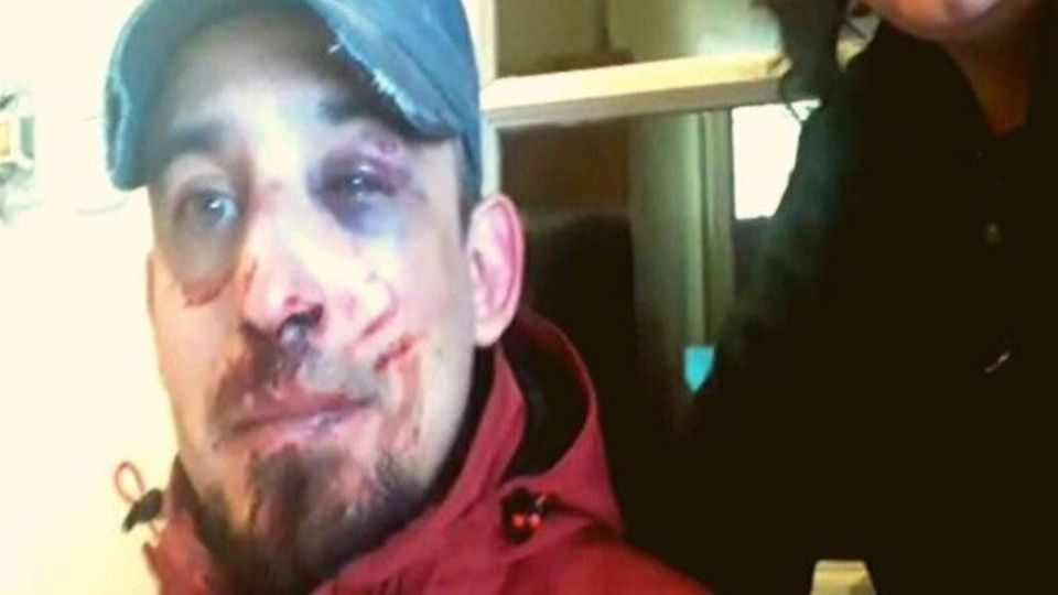 Bahía Blanca. Sacó a pasear a su perro y recibió una brutal golpiza de la Policía.