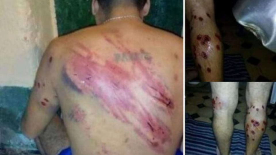 Tres detenidos de la Unidad 42, donde se registró el primer caso de coronavirus, denunciaron que fueron agredidos por los guardias.