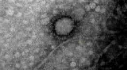 primera foto del coronavirus