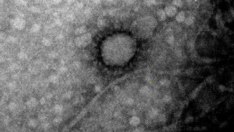 Primera imagen del coronavirus SARS-CoV-2 que circula en Argentina.