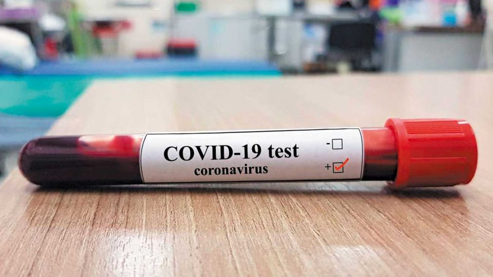 Test. El virus acelera tendencias, hace más visible lo que ya estaba (apenas disimulado o inhibido).