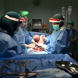 Esta foto tomada el 10 de mayo de 2020 muestra a la enfermera Fatimah Tuzahroh (L) ayudando al obstetra-ginecólogo Priyo Yudhosari (2 ° L) y al obstetra-ginecólogo Ika Sri Purnamaningsih (centro R) con equipo de protección durante un parto por cesárea en la clínica de maternidad RSIA Tambak en Yakarta - Como el personal de primera línea del hospital se enfrenta constantemente a los riesgos del brote de coronavirus COVID-19, el mundo celebra el Día Internacional de las Enfermeras el 12 de mayo. Durante el brote de coronavirus COVID-19, los hospitales en Indonesia solo permiten una persona de apoyo durante el parto, con Las reglas cambian constantemente a medida que aumentan los casos. (Foto por ADEK BERRY / AFP) | Foto:AFP