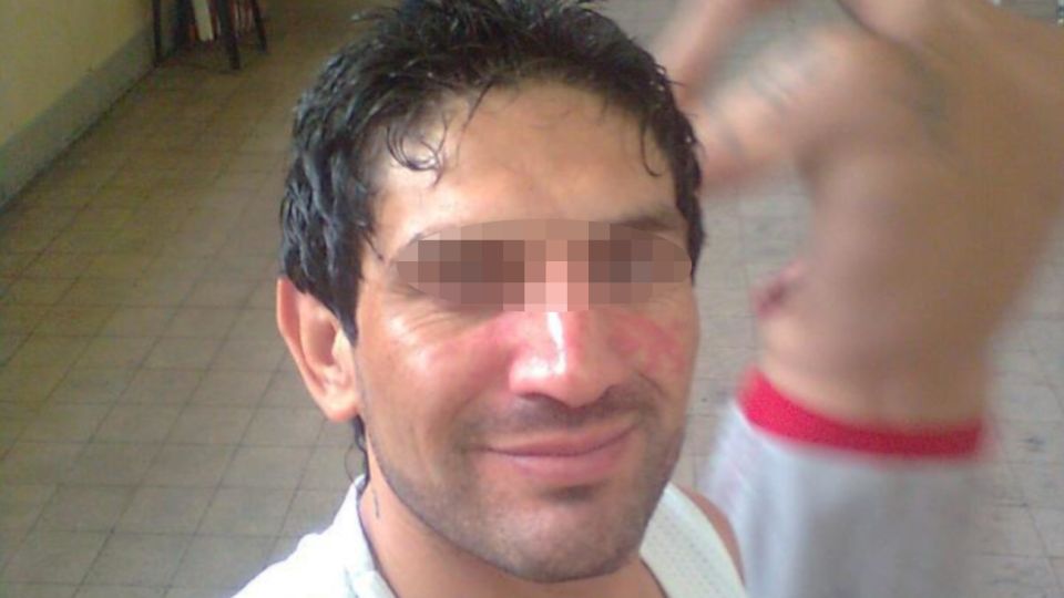 Gustavo Gatti lleva cerca de diez años detenido. Salió hace dos semanas porque tiene hepatitis C.