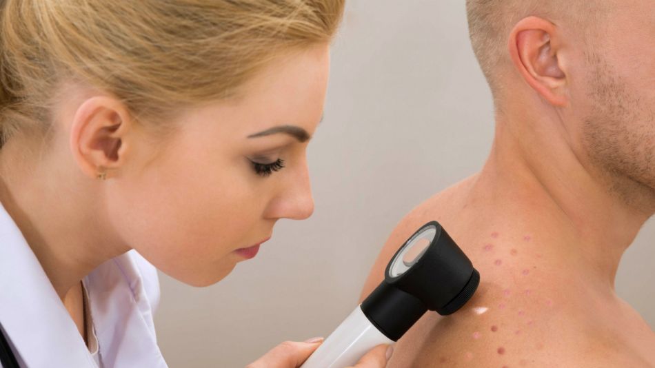 23 de mayo, Día Mundial del Melanoma