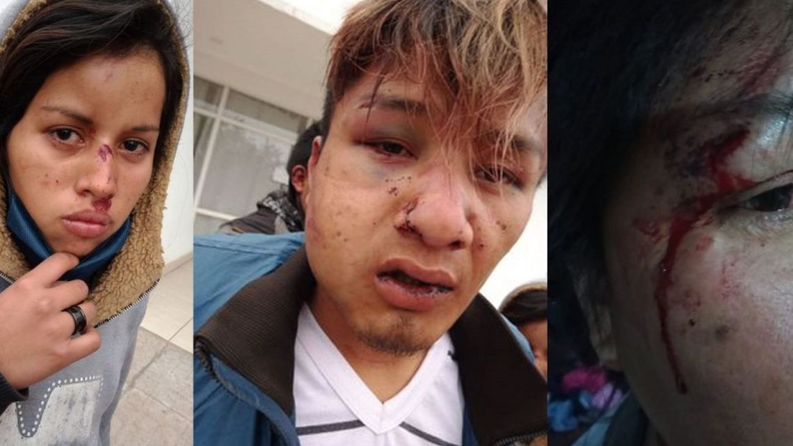 Images of injuries received by the victims at the hands of the police circulated on social media this week. 
