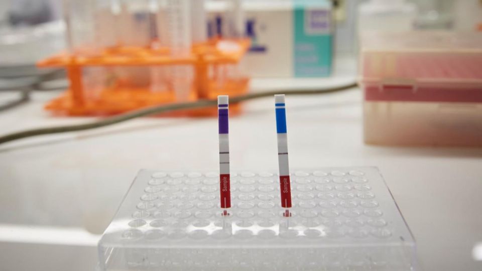 Científicos argentinos desarrollaron un segundo kit diagnóstico de COVID-19.