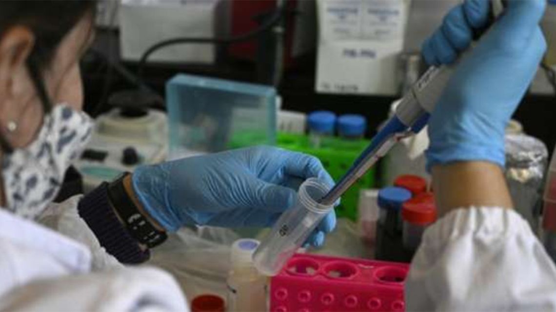 Researcher works on research of the Sars-Cov-2 virus protein, which causes COVID-19, in a lab in Buenos Aires, June 2, 2020
