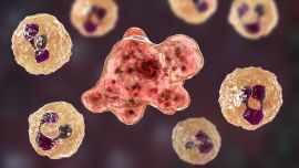 Sus síntomas incluyen fiebre, náusea, vómito, dolor de cuello y de cabeza y la mayoría de los pacientes que contraen la infección mueren en una semana.