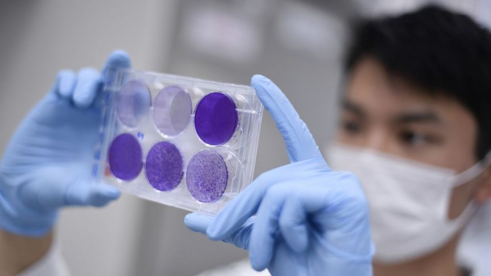 Comenzó a testarse en profesionales de la salud. Luego lo será en nueve mil voluntarios.