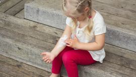 Dermatitis Atópica: nuevas guías para pacientes