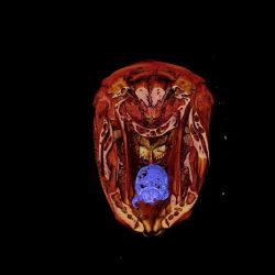 Los piojos come-lenguas no son un hallazgo común en las tomografías computarizadas y no se sabe qué tan comunes son entre los peces. 