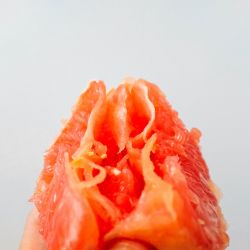 Labioplastia, la operación de los labios de la vulva