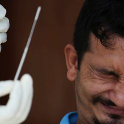 Nepal, Katmandú: un hombre reacciona después de dar una muestra de hisopo para la prueba de coronavirus. | Foto:Sunil Sharma / ZUMA Wire / DPA