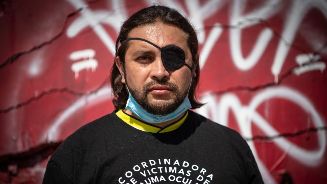 Welder Felipe Riquelme, 41, poses where he was hit by tear gas fired by the police while taking part in a protest, an event which left him blind in one eye.