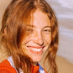 Las pecas ganan protagonismo y se convierten en tendencia