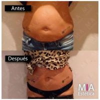 Mía Estética