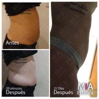 Mía Estética