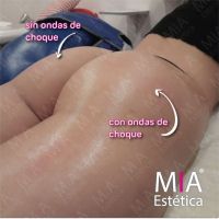 Mía Estética