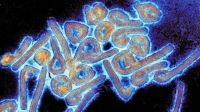 El virus chapare bajo el microscopio electrónico. 