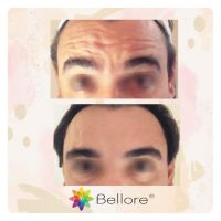 Bellore