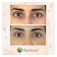 Bellore