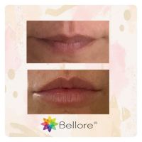 Bellore