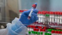 Origen del virus COVID-19
