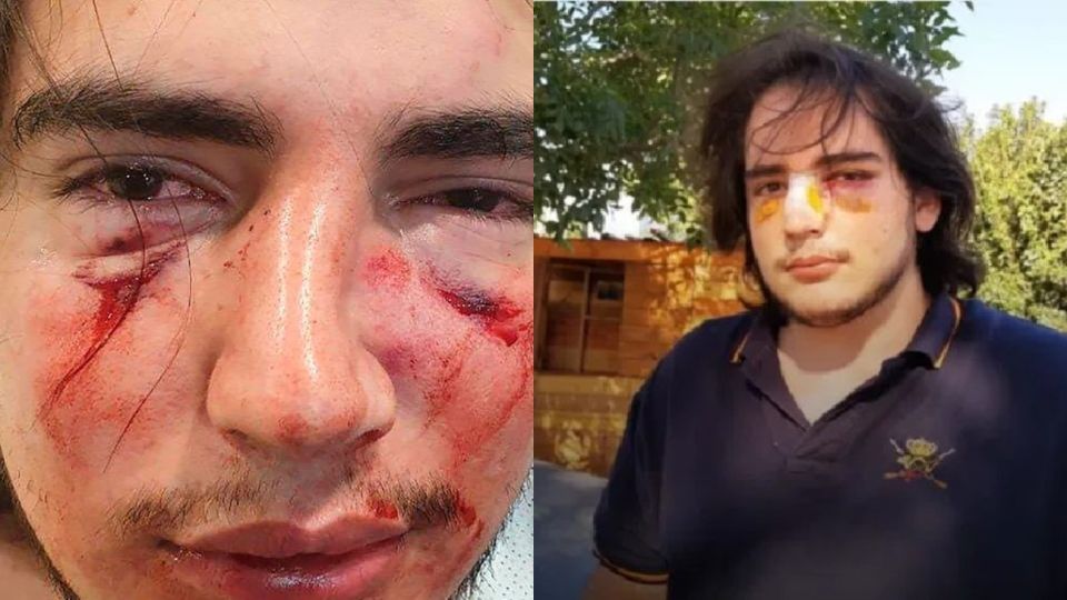 Un grupo de rugbiers del Tala Club que intentó participar sin estar invitado en una fiesta privada de egresados golpeó violentamente a un joven en la provincia de Córdoba, provocándole fracturas de tabique nasal y de pómulo.