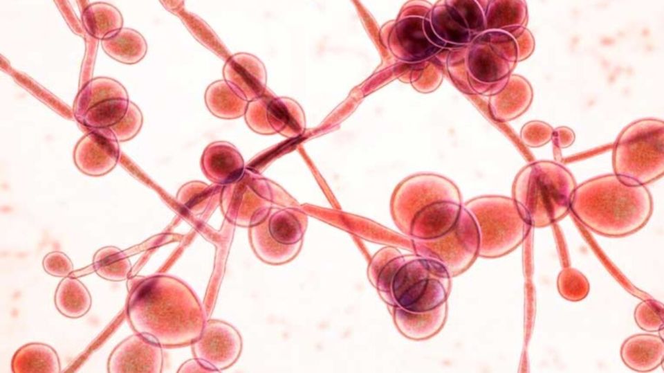 Candida Auris Hongo Brasil 2